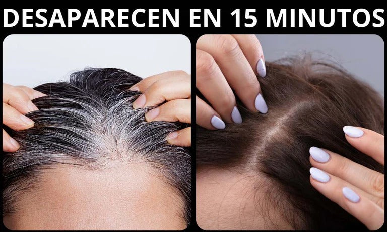 Shampoo Cubre Canas + Tratamiento🎁