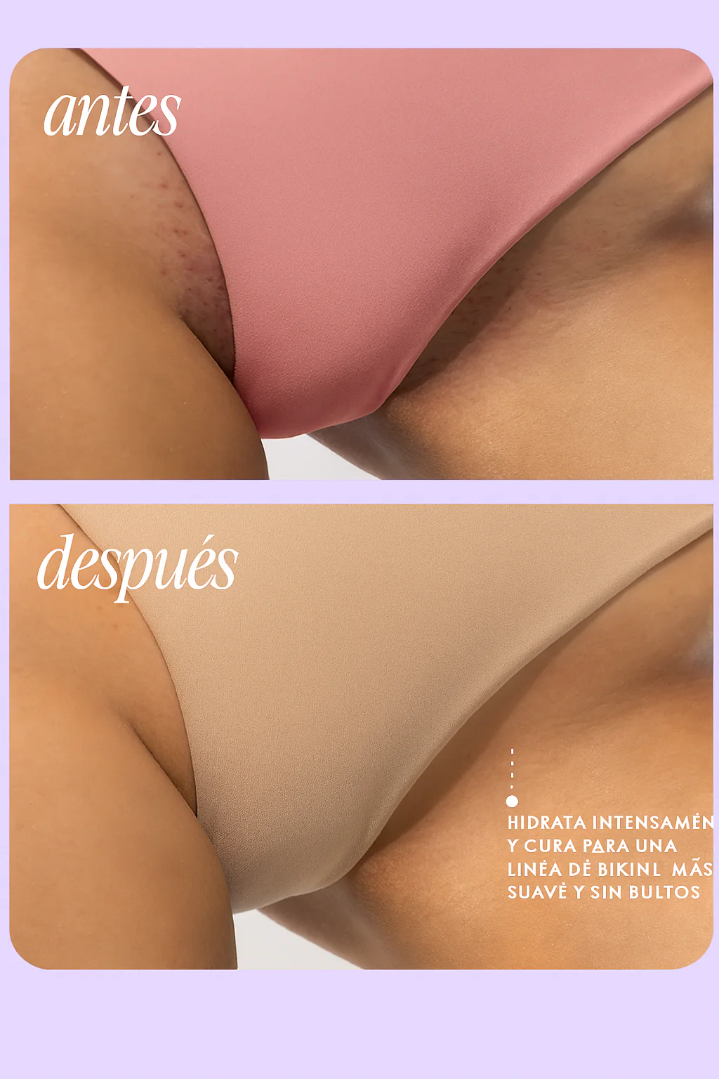 SOFT SERVE Serum ✅ - 2x1 OFERTA ESPECIAL